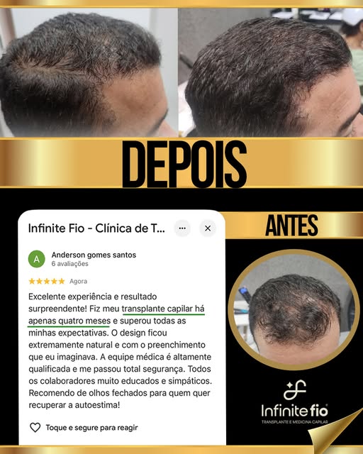 Quatro meses depois, a mudança já aparece no espelho — e também nas palavras de quem viveu todo o pr