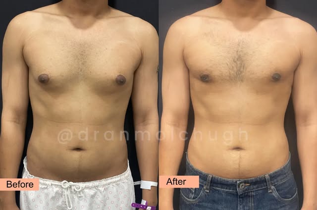 ✨ 𝐀 𝐦𝐨𝐫𝐞 𝐝𝐞𝐟𝐢𝐧𝐞𝐝 𝐜𝐡𝐞𝐬𝐭 𝐜𝐚𝐧 𝐦𝐚𝐤𝐞 𝐚 𝐛𝐢𝐠 𝐝𝐢𝐟𝐟𝐞𝐫𝐞𝐧𝐜𝐞 𝐢𝐧 𝐜𝐨𝐧𝐟