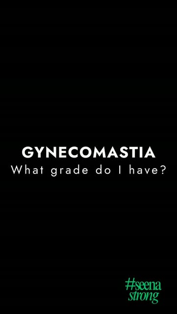 Not every case of gynecomastia is the same. Understanding the grade helps determine the right treatm