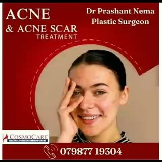#advance scar treatment # Scar revision # post trauma scar treatment#acne scar treatment #facial sca