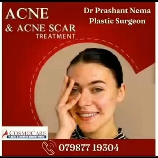 #advance scar treatment # Scar revision # post trauma scar treatment#acne scar treatment #facial sca