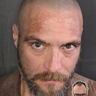 ⚫️Per anni ha portato i capelli in avanti, non per scelta, ma per nascondere il disagio di una front