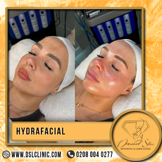 Hydration hero! ✨ The HydraFacial at Diamond Skin Aesthetic is your secret weapon for a dewy, radian