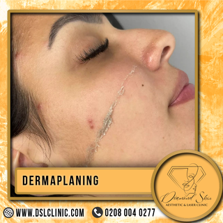 ✨ Unleash your inner glow with Dermaplaning at Diamond Skin Aesthetic in Wembley! ✨ This gentle exfo