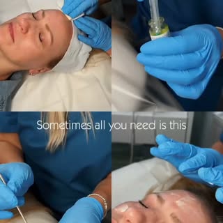 Yes you can have a peel in the summer with my two incredible summer peels to refresh and hydrate you