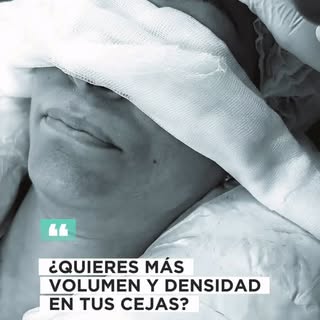 Si buscas mayor densidad y volumen con un resultado totalmente natural, el microinjerto de cejas de 