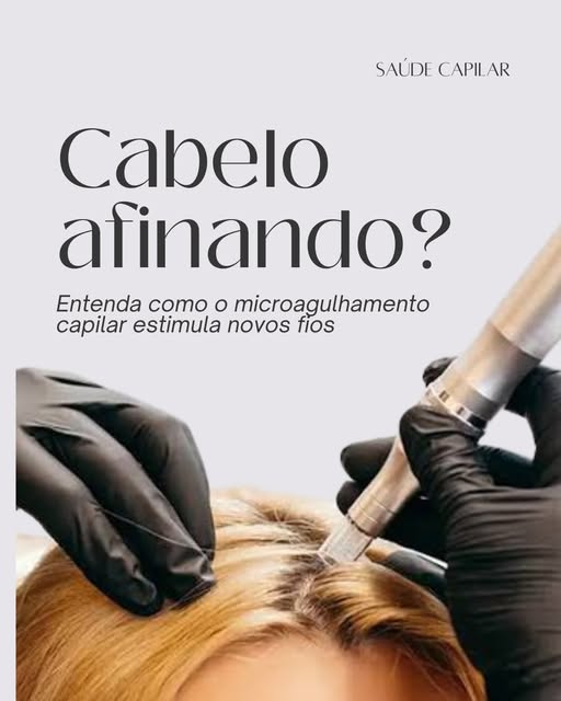 Você sente que seu cabelo está afinando ou caindo mais que o normal?

O microagulhamento capilar age