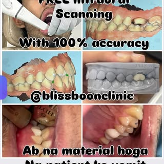 Now upgraded to FREE Intraoral Scanning
Ab na material hoga Na patient ko vomit or taste ki pareshan
