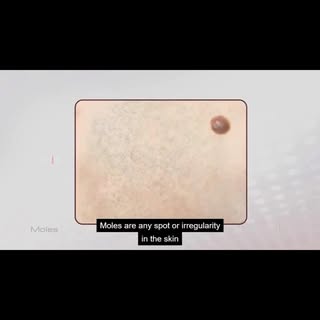 Kya aapke b Moles h?
Kbhi kbhi lgta h ki kya h aur kyou h je? 
Then watch this educational video 
#b