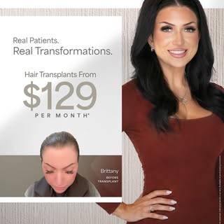 Your hair transplant results shouldn’t be one-size-fits-all. ✨ Neither is the way we help you get th