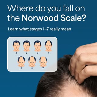 August is Hair Loss Awareness Month ✨, making it the perfect time to better understand your hair los
