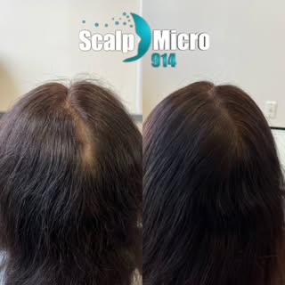 Tired of seeing hair gaps or your scalp showing no matter how you style it?

If you find yourself co