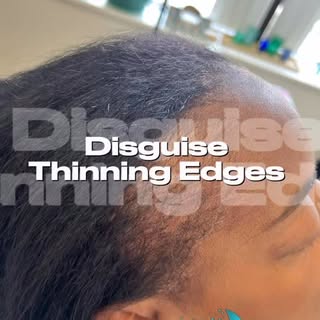 Do you suffer from traction alopecia?

Traction alopecia is hair loss caused by constant tension fro