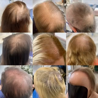 Struggling with Hair Loss and thinking about a hair system? Here’s some info from our salon 👇

We’v