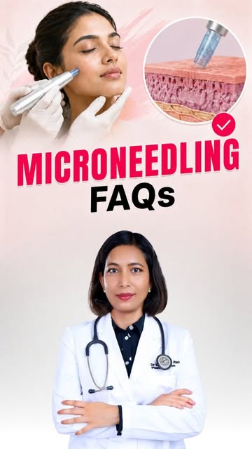 5 Microneedling Myths You Need to Stop Believing! 🛑✨

​Think microneedling is painful, only for acn