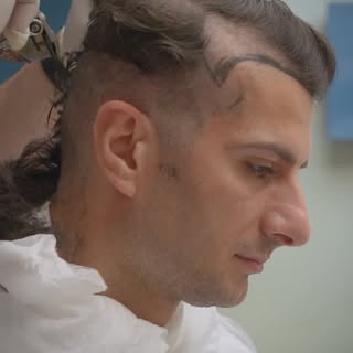 Get your own experience of and journey for hair restoration starting from the link on our bio #clini