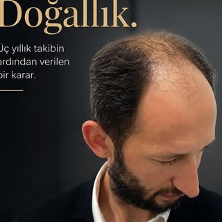 Üç yıl boyunca takip etti.
Araştırdı, karşılaştırdı, bekledi.

Çünkü onun için mesele yalnızca saçla