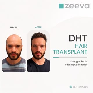Confidence Restored. Naturally.

Hair restoration isn't just about growing hair—it's about restoring