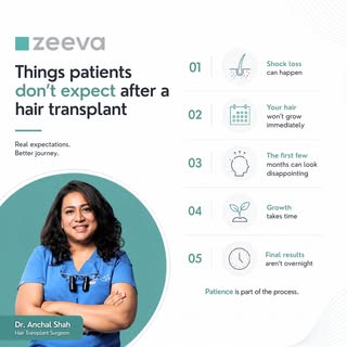 Things Patients Don’t Expect After a Hair Transplant

A hair transplant is a journey, not an overnig