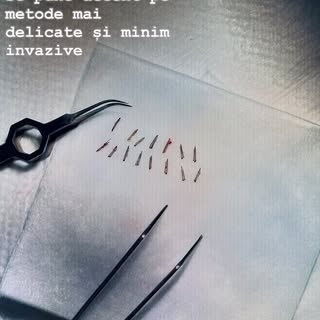 Clinica THE ONE lucrează cu instrumente de ultimă generație, metodele folosite de echipa noastră sun