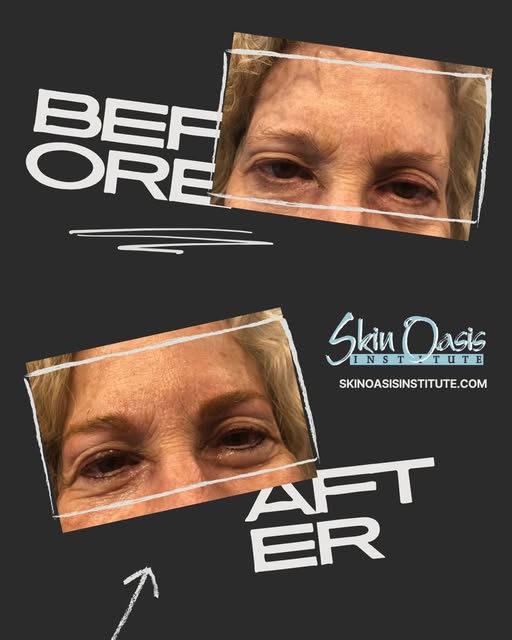 The holidays are right around the corner. Is your permanent makeup ready? ✨

Now is the perfect time