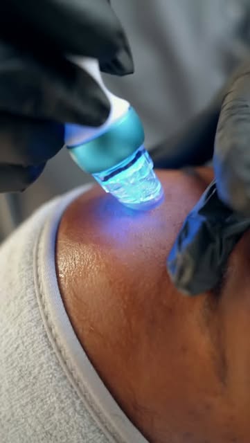 Deep cleanse. Hydrate. Refresh. ✨⁠
⁠
A HydraFacial is designed to cleanse, exfoliate and replenish t