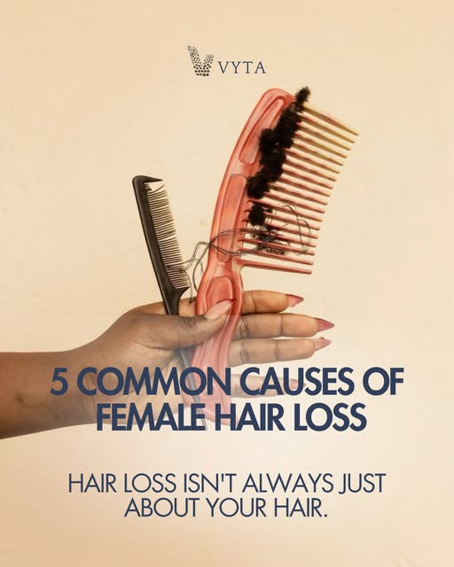 Hair loss isn’t always just about your hair, it can be your body telling you something. 🌱⁠
⁠
Hormon