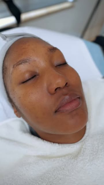 Sometimes your skin doesn’t need more products, it needs a reset. ✨⁠
⁠
A chemical peel can help impr