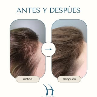 Resultados ✨ Ver a nuestros pacientes recuperar su sonrisa es lo que nos mueve.
Si quieres recuperar