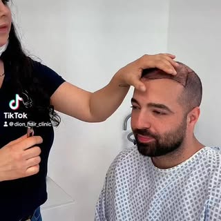 Kennt ihr auch jemanden, der eine misslungene Haartransplantation hatte?  Verlinkt ihn gerne hier.

