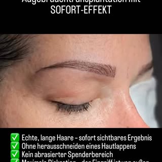 ✨ Augenbrauentransplantation mit echten, langen Haaren – ohne Kompromisse.

Warum sollten für natürl