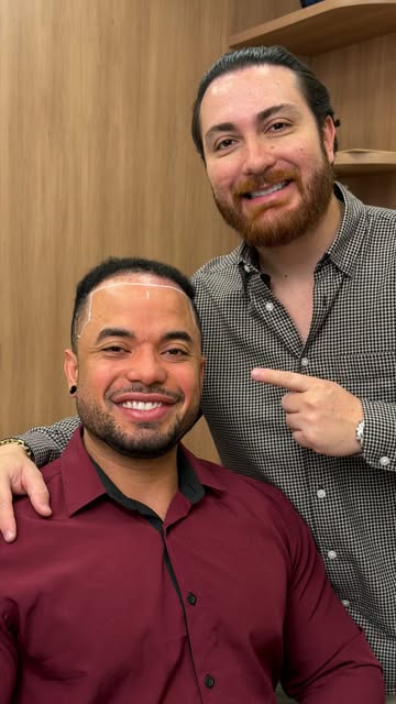 Parabéns ao @teamlucassantana por realizar seu transplante capilar!!
Algumas mudanças você percebe n