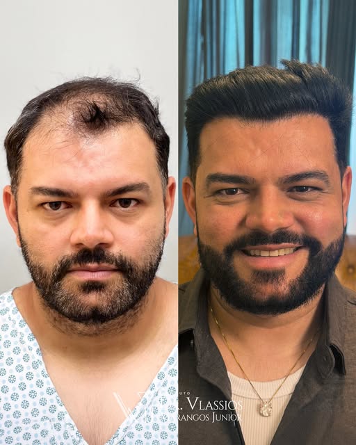 Cabelo não é apenas cabelo. Cabelo é jovialidade, é autoestima, é se sentir bem, independente da oca