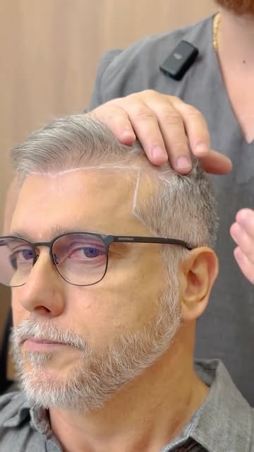 Há momentos em que mudar um detalhe
muda a forma de viver o todo.
O transplante capilar do @adricast