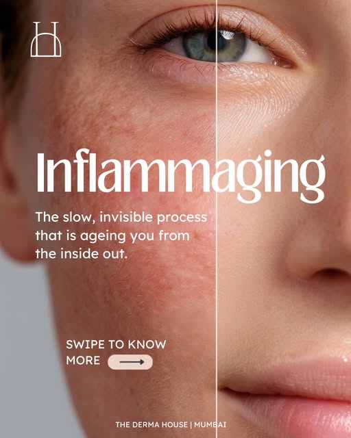 What is INFLAMMAGING?
.
.
#dermatology #skininflammation #skinconcerns #thedermahouse #drmanuwalia
