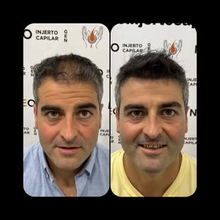 Coleccionando éxitos.

Último día de cirugías y de revisiones y siempre es una alegría poder termina