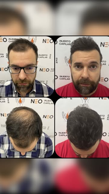 Coleccionando Éxitos 🙌

Nuevo caso, diseñado para recuperar densidad y redefinir la línea frontal d