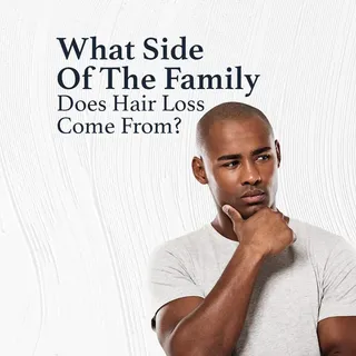 A lot of the patients I see are always curious about who they got their hair loss from…

And especia