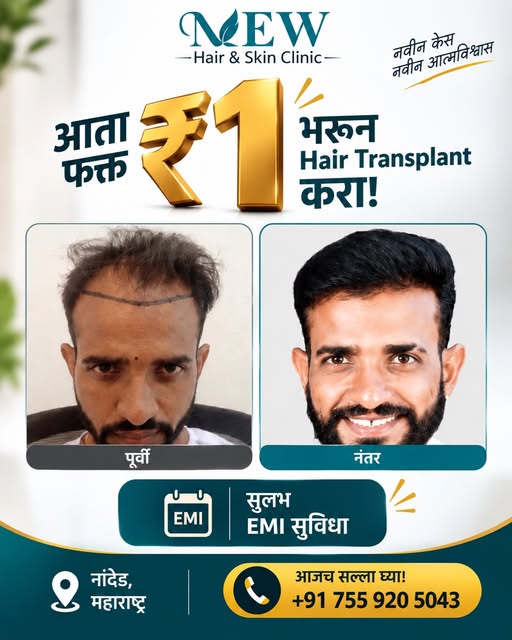 Hair Transplant चा विचार करताय? आता सुरुवात आणखी सोपी! ✨

नांदेडमध्ये ₹1 पासून Hair Transplant करण्य