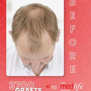 If you’re experiencing hair-related issues, we can work together to find the solution that’s best fo