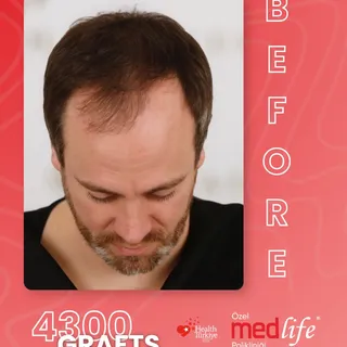 If you’re experiencing hair-related issues, we can work together to find the solution that’s best fo