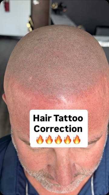 This client flew in from Florida to get his SMP corrected! So he had 2 sessions with another artist,