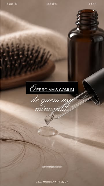 Minoxidil pode ajudar muito. Mas sozinho, ele não resolve todos os tipos de queda.

Quando usado sem