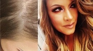 FREE CONSULTATION,
Hair Loss affects about 30 million American women, but a strong woman's strength 