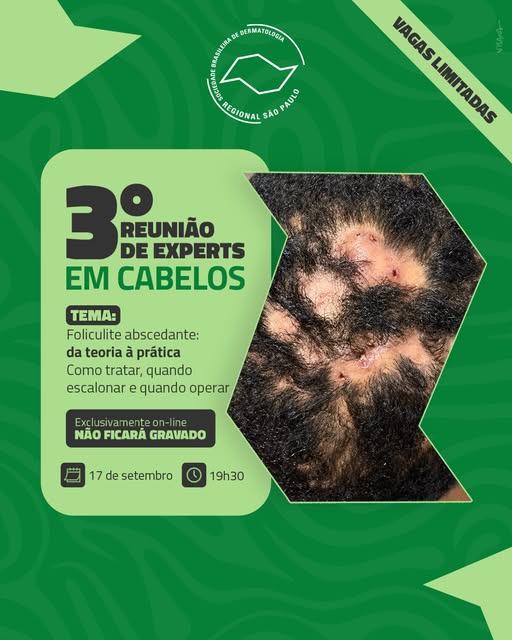 Temos um encontro marcado no dia 17/9, às 19h30, para discutirmos foliculite abscedante, passando pe