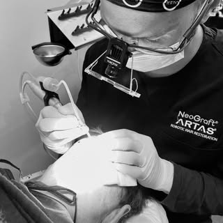 Precision and concentration - Neograft FUE hair transplantation