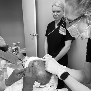 FUE hair transplant. Manual implantation #FUE #hairtransplantation