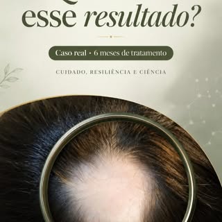 Do story pro feed !

Tem momentos na nossa vida que nós precisamos assumir as rédeas e nos priorizar