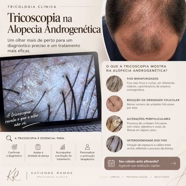 🔬 Tricoscopia: um olhar que faz diferença na avaliação capilar

A tricoscopia é uma ferramenta fund