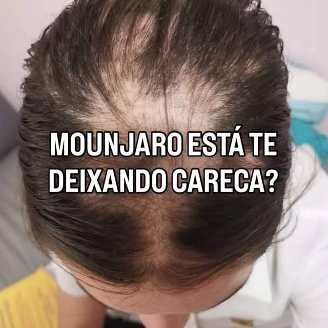 "VOCÊ ESTÁ CUIDANDO DO SEU CORPO....MAS E DO SEU CABELO?" 

Você está vivendo uma transformação. 💚
